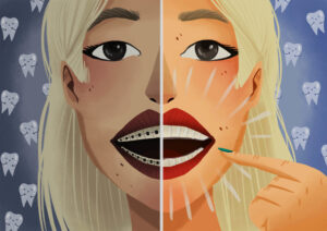 woman comparing traditional braces vs invisalign clear aligners
